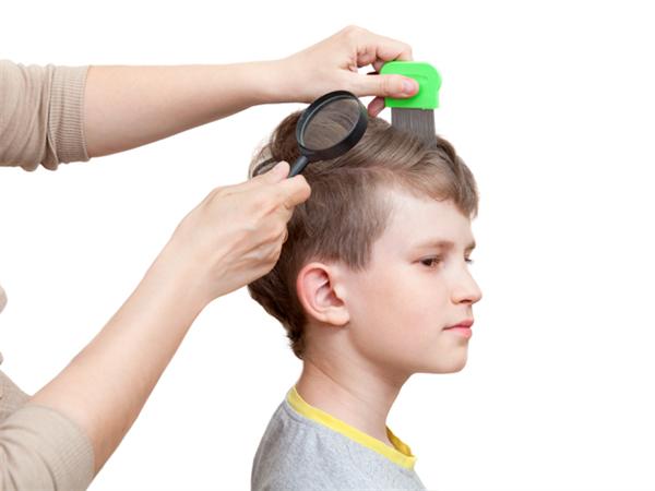 Head Lice Head Lice